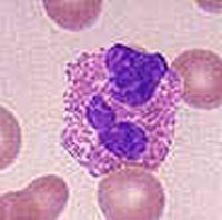 Image of an eosinophil
