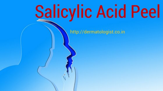 Chemical Peel with Salicylic Acid
