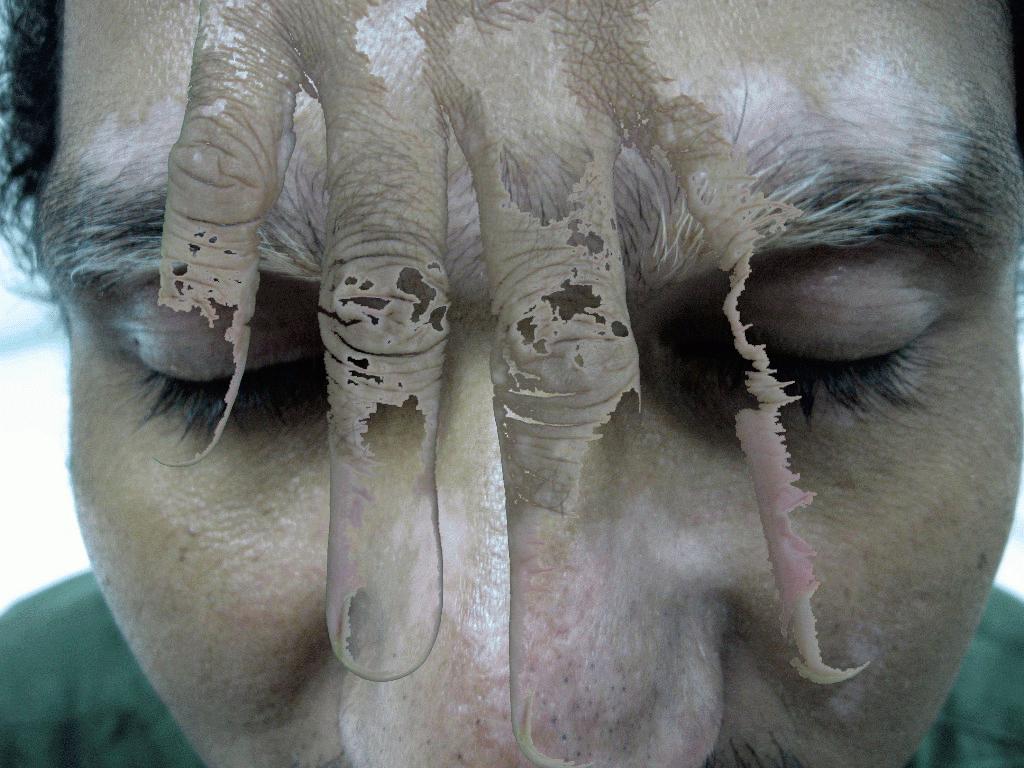 Teledermatology