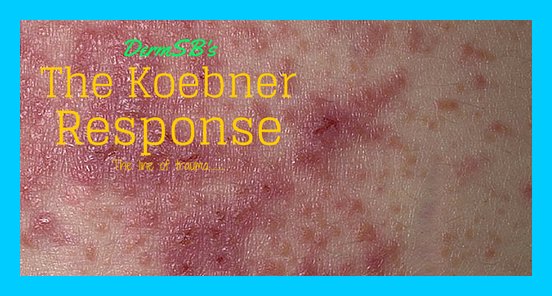 The Koebner Phenomenon - Dermatologists Sans Borders